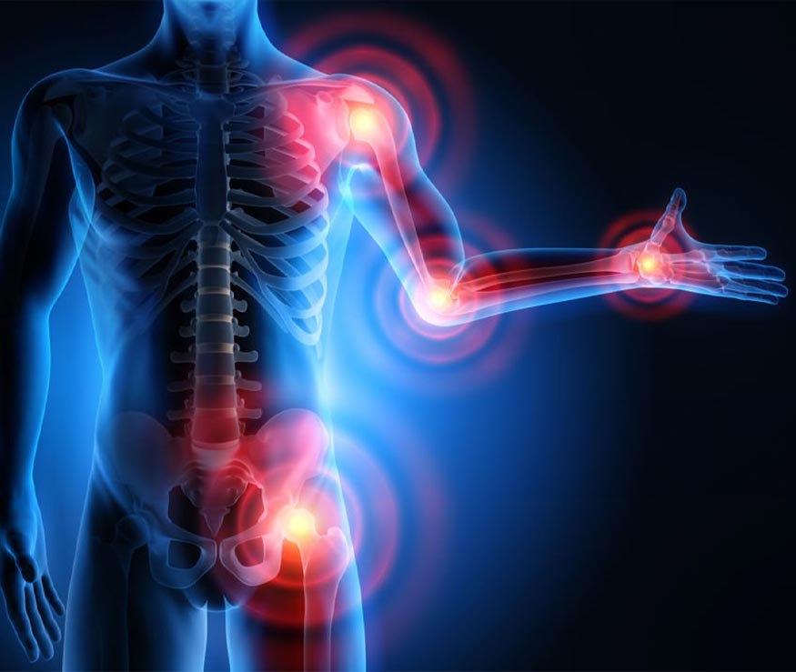 A digital illustration highlights joint pain in a human body with glowing red circles.